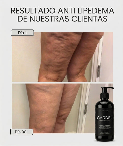 GARDEL DERMODELUXE - PARA LIPEDEMA Y CELULITIS AVANZADA