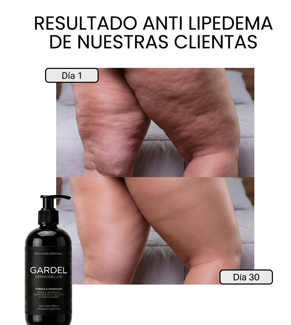 GARDEL DERMODELUXE - PARA LIPEDEMA Y CELULITIS AVANZADA